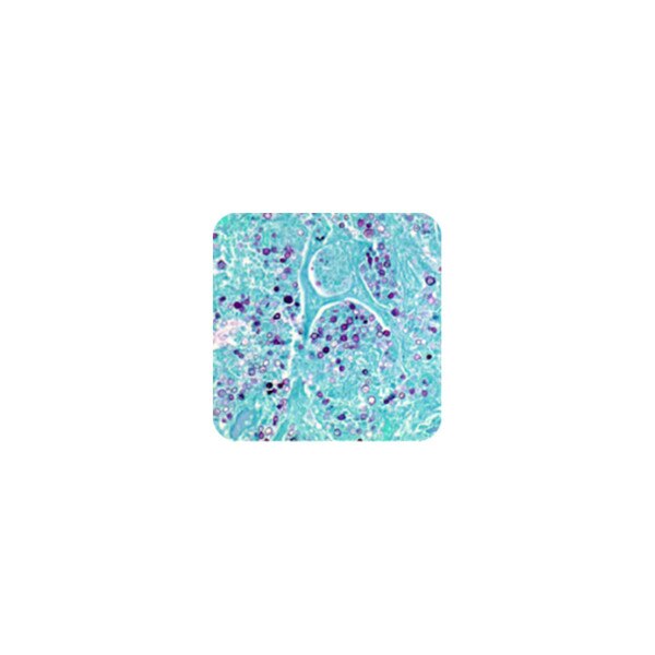 Periodic Acid Schiff (PAS)